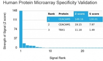 CEA Antibody / Carcinoembryonic Antigen