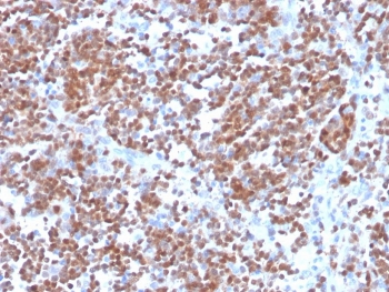 Cyclin D1 Antibody / CCND1