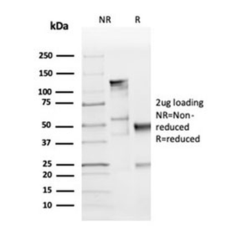 Cyclin D1 Antibody / CCND1