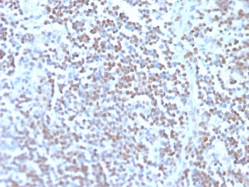 Cyclin D1 Antibody / CCND1
