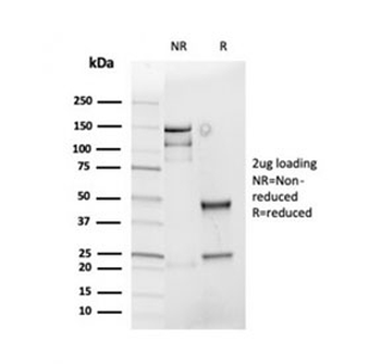 Cyclin D1 Antibody / CCND1