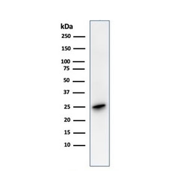 PGP9.5 / UchL1 Antibody