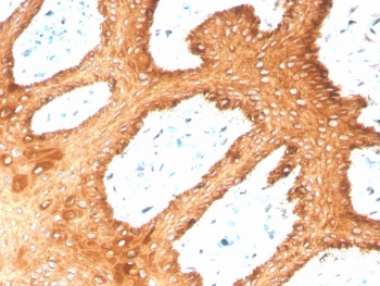 Recombinant Type II Cytokeratin Antibody (CK1-8)