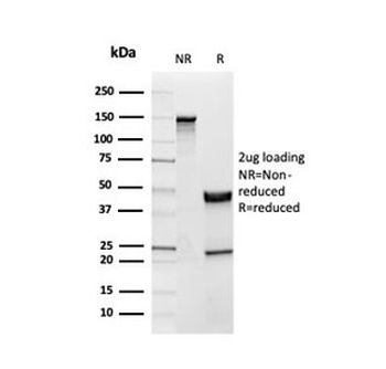 INHA Antibody / Inhibin alpha