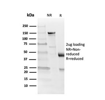 MBP Antibody / Myelin Basic Protein