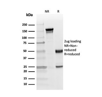 MBP Antibody / Myelin Basic Protein