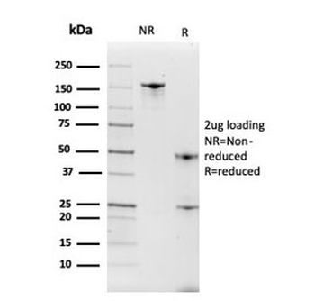 ITLN1 Antibody / Intelectin 1 / Omentin