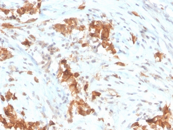 Mesothelin Antibody / MSLN