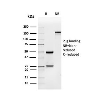 BMP15 Antibody
