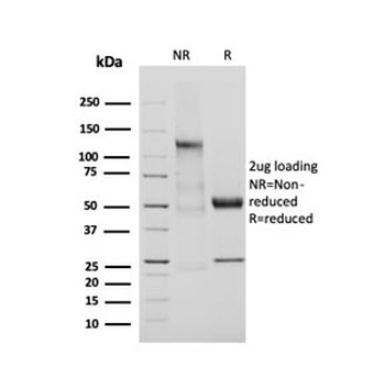 Adiponectin Antibody
