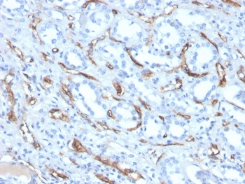 Adiponectin Antibody