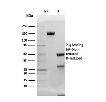 Adiponectin Antibody