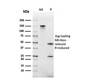 BAFF-R Antibody / BAFF Receptor