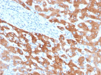 Retinol Binding Protein 4 Antibody / RBP4