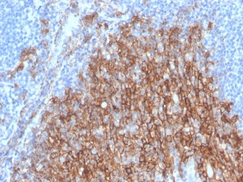 Syndecan-1 Antibody / CD138