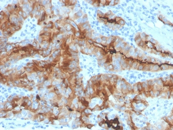 Recombinant Thyroglobulin Antibody