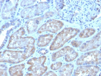 Fibroblast Growth Factor 23 Antibody / FGF-23