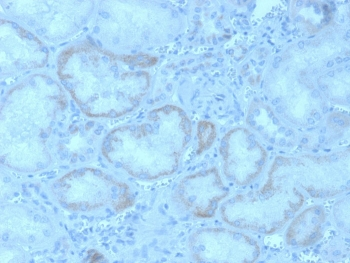 Fibroblast Growth Factor 23 Antibody / FGF-23