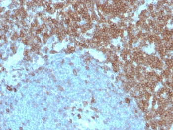 CD27 Antibody