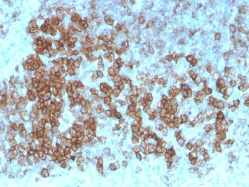 CD27 Antibody