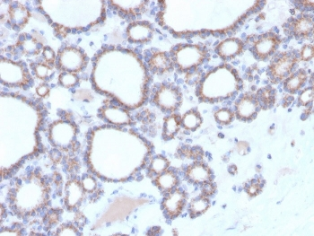 DBC2 Antibody / RHOBTB2