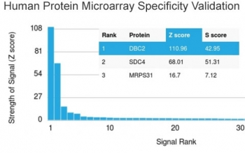 DBC2 Antibody / RHOBTB2