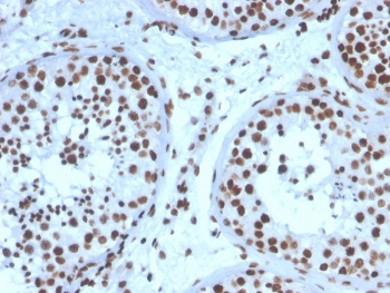 Steroidogenic Factor 1 Antibody / SF-1 / NR5A1