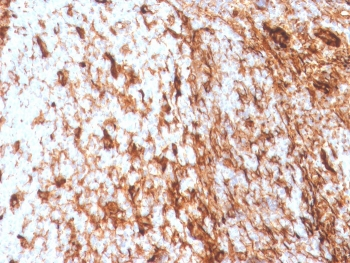 Vimentin Antibody