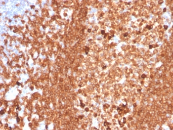 CD79a Antibody