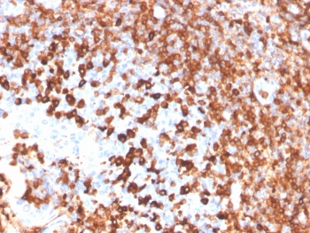 CD79a Antibody