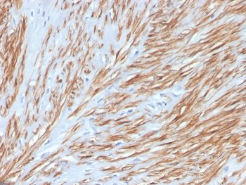 Calponin-1 Antibody