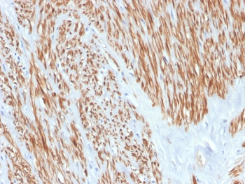 Calponin-1 Antibody