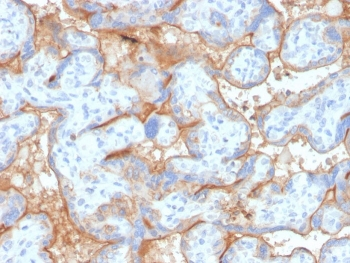 EGF Receptor / EGFR Antibody