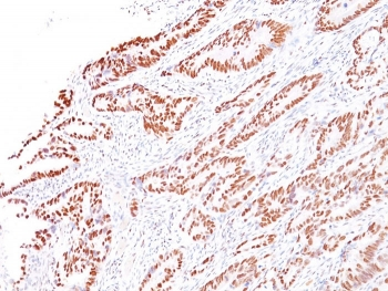 MLH1 Antibody / MutL Homolog 1