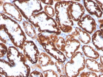 FGF23 Antibody / Fibroblast Growth Factor 23