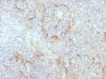 TIM-3 Antibody / HAVCR2