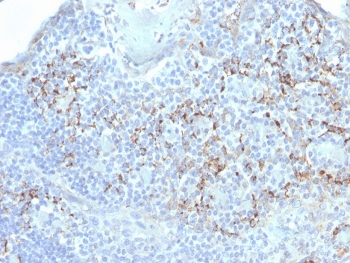 TIM-3 Antibody / HAVCR2