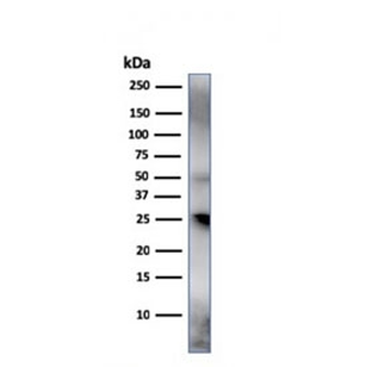 TIM-3 Antibody / HAVCR2