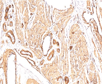 Alpha Actin Antibody / ACTA2 (smooth muscle)