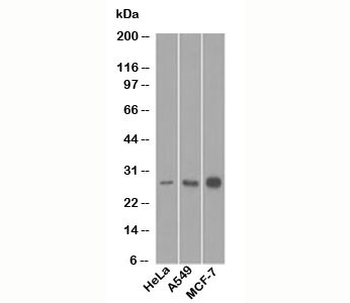 Bcl-2 Antibody