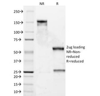 Bcl-2 Antibody