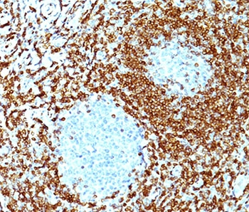 Bcl-2 Antibody Cocktail