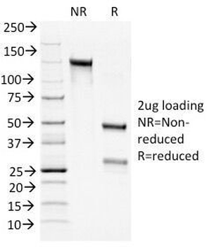 Bcl-2 Antibody Cocktail