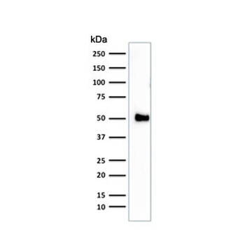 CD2 Antibody