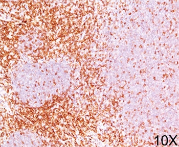 CD6 Antibody