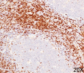 CD6 Antibody