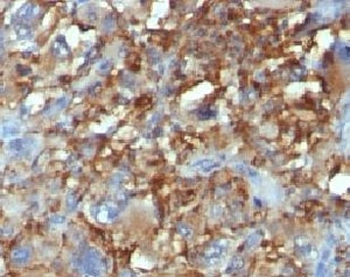 CD68 Antibody