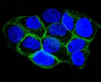 EGF Receptor / EGFR Antibody