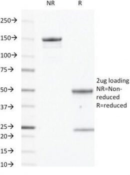 EGF Receptor / EGFR Antibody