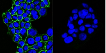 EGF Receptor / EGFR Antibody